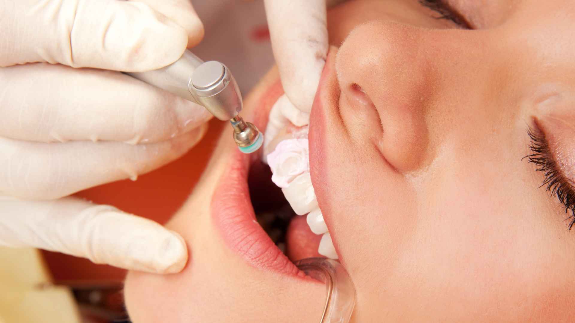 טיפולי שיקום הפה והשיניים